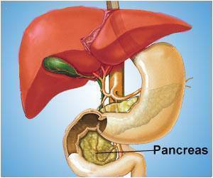Type 2 Diabetes Remission can Restore Pancreas Size and Shape