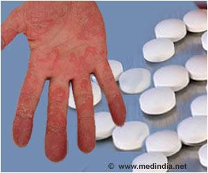New Drug Briakinumab May Be the Answer for Psoriasis