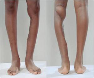 Coming Soon: Touch-Sensitive Prosthetic Limbs