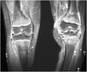  Computer Implants Could Help Nerves Rewire Themselves