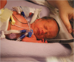 Doctors Use Artificial Lungs to Save a Newborn Baby for the Very First Time in India
Doctors Use Artificial Lungs to Save a Newborn Baby for the Very First Time in India