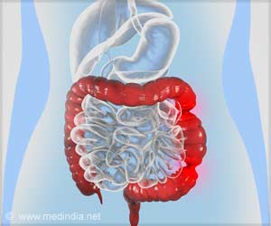 Irritable Bowel Syndrome Risk Among Young Adults