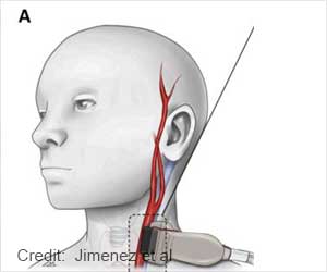 Sound-Based Blood Pressure Monitoring