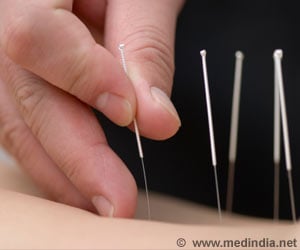 Electroacupuncture Regulates Blood Sugar Levels in Obese Women