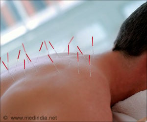 Electroacupuncture- Promotes Tissue Healing, Relieves Pain