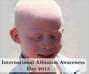 International Albinism Awareness Day 2015