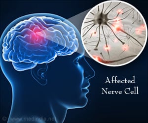 New ALS Medication More Effective Compared to Existing Ones