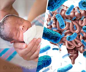 Antibiotics in Preterm Infants May Affect Their Healthy Gut Bacteria