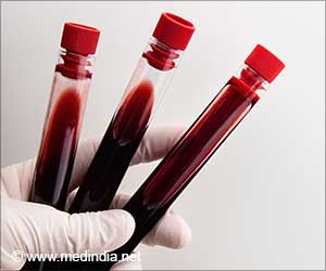 Artificial Blood can Save Your Life