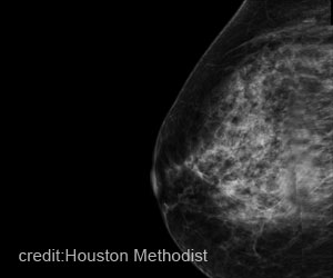 Artificial Intelligence Software Expedites Efficient Prediction of Breast Cancer Risk