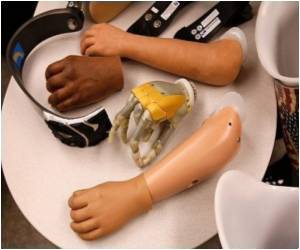  Bionic Hand Helps Prosthetics Get A Human Touch
