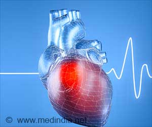 Atrial Fibrillation Common Among Young Individuals