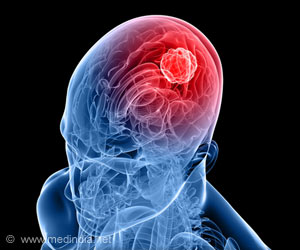 Combination of Drugs may Improve Survival in Brain Cancer