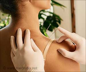 Can Chest Pain be Treated With Acupuncture?