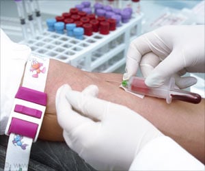 One Liquid Biopsy - Screening for Many Types of Cancer