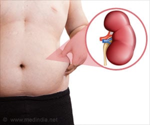  Influence of Body Mass Index on Renal Transplant Outcomes