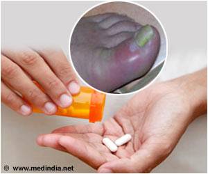 Antihypertensive Medications Associated With Gout