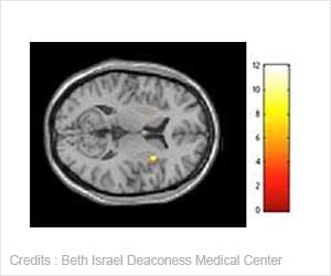 How AI Brain Scan Spots Urgent Cases for Rapid Diagnoses How AI Brain Scan Spots Urgent Cases for Rapid Diagnoses