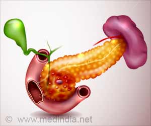 Pancreatic Cancer: Bacteria on Tumors Affect Immunity and Survival of Patients