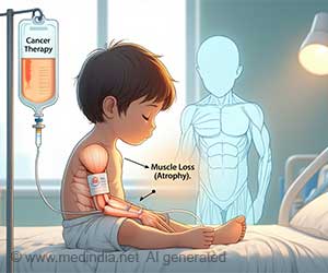 Does Childhood Cancer Therapy Strip Away Kids' Muscles?