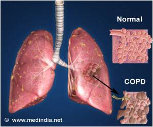 Novel Healthcare App Decreases COPD Symptoms 
