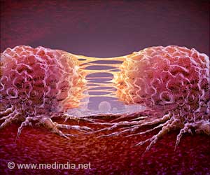  Natera Loses Some Patents in Dispute With NeoGenomics, But Key Protections Remain