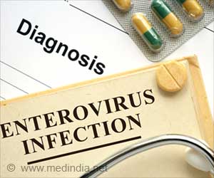 Summer Alert: Enterovirus Outbreaks on the Rise!