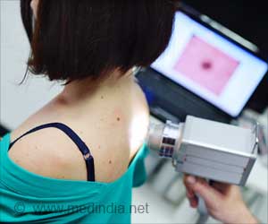 Artificial Intelligence (AI) Performs Better Than Dermatologists in Diagnosing Skin Cancer