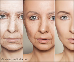 Cutting Down Calories Slows Aging Process in Mice