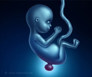 Possible Mechanism of Protective Effect of Folic Acid in Neural Tube Defects