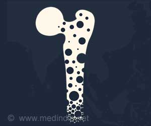 Parathyroid Hormone Based Drug Helps Treat Osteoporosis