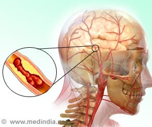 Momentary Fury Can Have Lasting Impact on Vascular Health