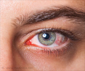 Treatment of Eye Diseases With Blood Products