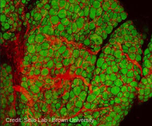 90 Genes in Fat Cells May Contribute to Diabetes and Heart Diseases