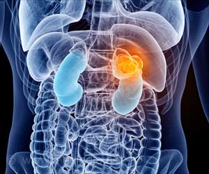 New Biomarkers Improve Renal Cancer Diagnosis