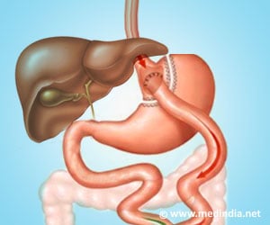 Gastric Bypass Surgery in Adolescents With Severe Obesity