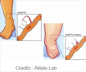 Novel Gene Mutation Identified in Generalized Lymph Node Swelling