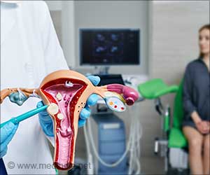Genes Play a Role in Uterine Fibroids