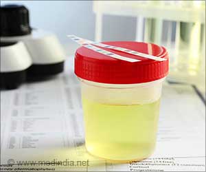 Urine Gene Test Could be the Next Tool to Predict Bladder Cancer