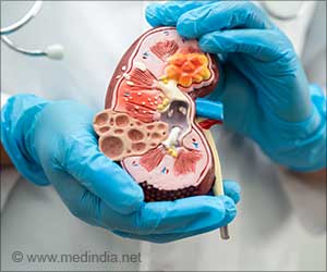 Origins of Common Kidney Disease Linked to Factors Beyond the Kidney