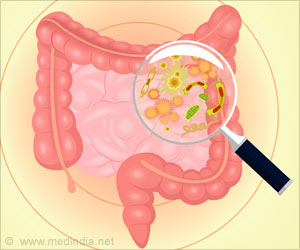  How Gut Microbes Influence Body Weight?