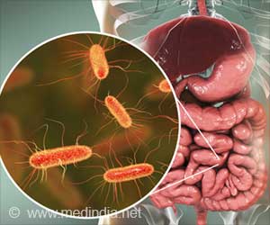 Gut Microbiome Wellness Index 2: Tool for Assessing Gut Health