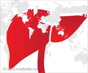 World Hepatitis Day (WHD) 2021: Hepatitis Cant Wait