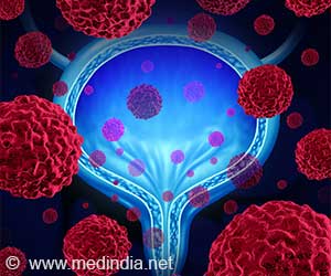 Diabetes Associated With Higher Bladder Cancer Risk