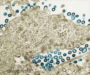 New Study Links HIV Drug Abacavir to Higher Cardiovascular Risk