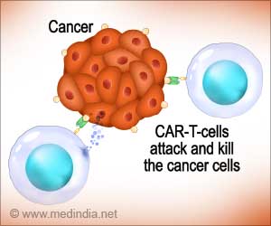 Indias First Homegrown CAR T-Cell Therapy to Treat Leukemia
