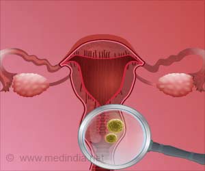 HPV Screening Test Might Just be Enough for Cervical Cancer Detection