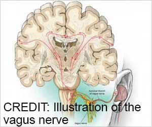 Nerve Stimulation Boosts Language Learning Skills