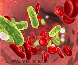 Measurement of Neutrophil Motility may Have Predictive Value in Sepsis