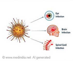 Rare Acanthamoeba Infection Diagnosed in 18-Year-Old